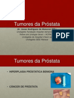 Aula UFAM Tumores da Próstata