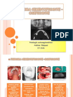 Fibroma Cementificante - Osificante