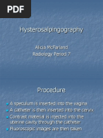 Hysterosalpingography