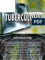 Tuberculosis Presentar
