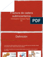 FX de Cadera Subtrocanterica