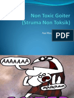 Non Toxic Goiter.pptx