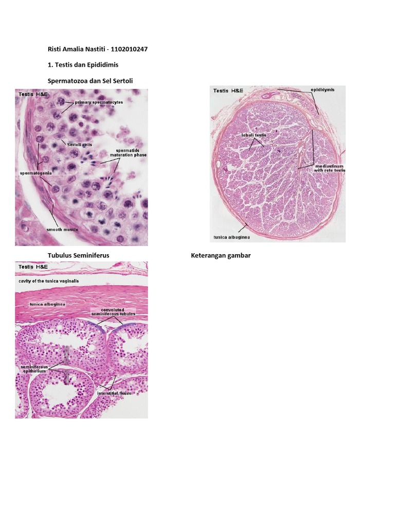 Histologi Testis dan Epididimis Sapi | PDF