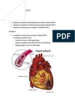 MI Jantung