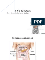 20110516 Tumores Pancreas