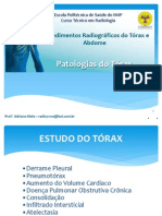 PATOLOGIAS DO TÓRAX