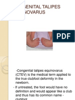 Congenital Talipes Equinovarus