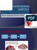 Insuficiencia Aortica