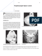 Pictorial Essay - Parapharyngeal Space Lesion