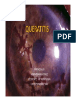 QUERATITIS