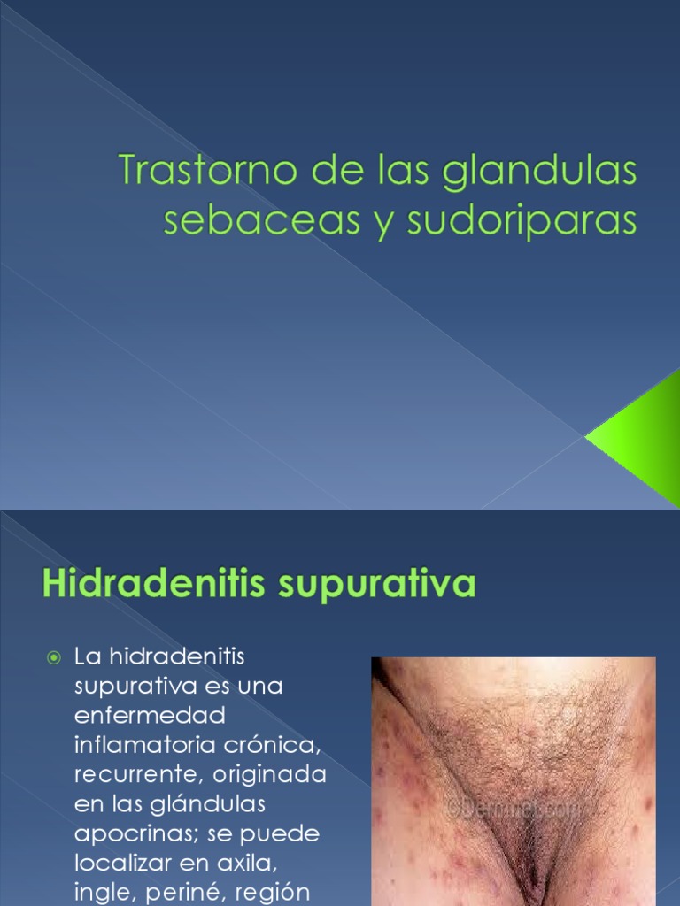Quanto às Glândulas Sebáceas é Incorreto Afirmar Que