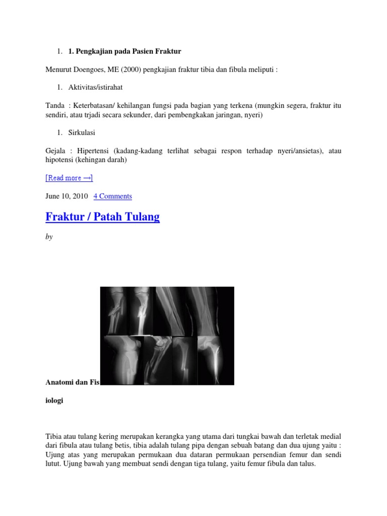 Fraktur Tibia Fibula | PDF | Kesehatan Holistik | Sains & Matematika