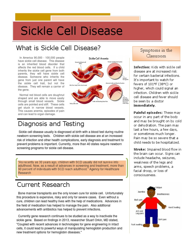 Sickle Cell Disease: Classroom Guide | PDF | Sickle Cell Disease ...