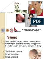 Sinusitis