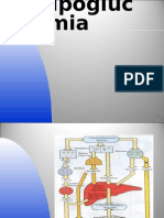 Hipoglucemia