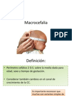 Macrocefalia