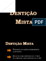 Ortodontia - Dentição mista graduação