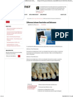 Fenestration Dehiscence PDF