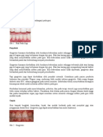 174241079-Gingivitis.pdf