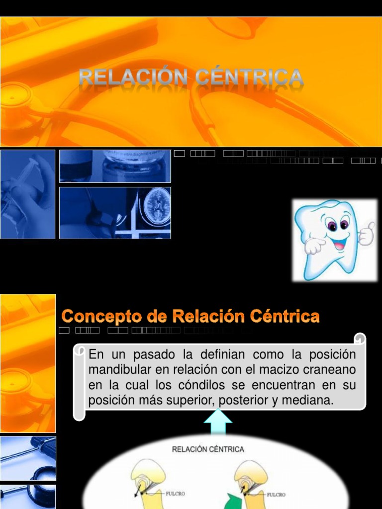 Relación Céntrica y Máxima Intercuspidación | PDF | Diente humano ...