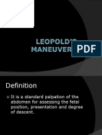 Leopold’s Maneuvers