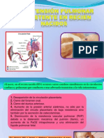 Hipertensión Pulmonar Persistente en Recién Nacidos Exp.