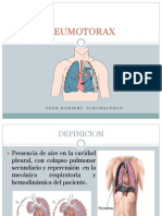 NEUMOTORAX Exposicion