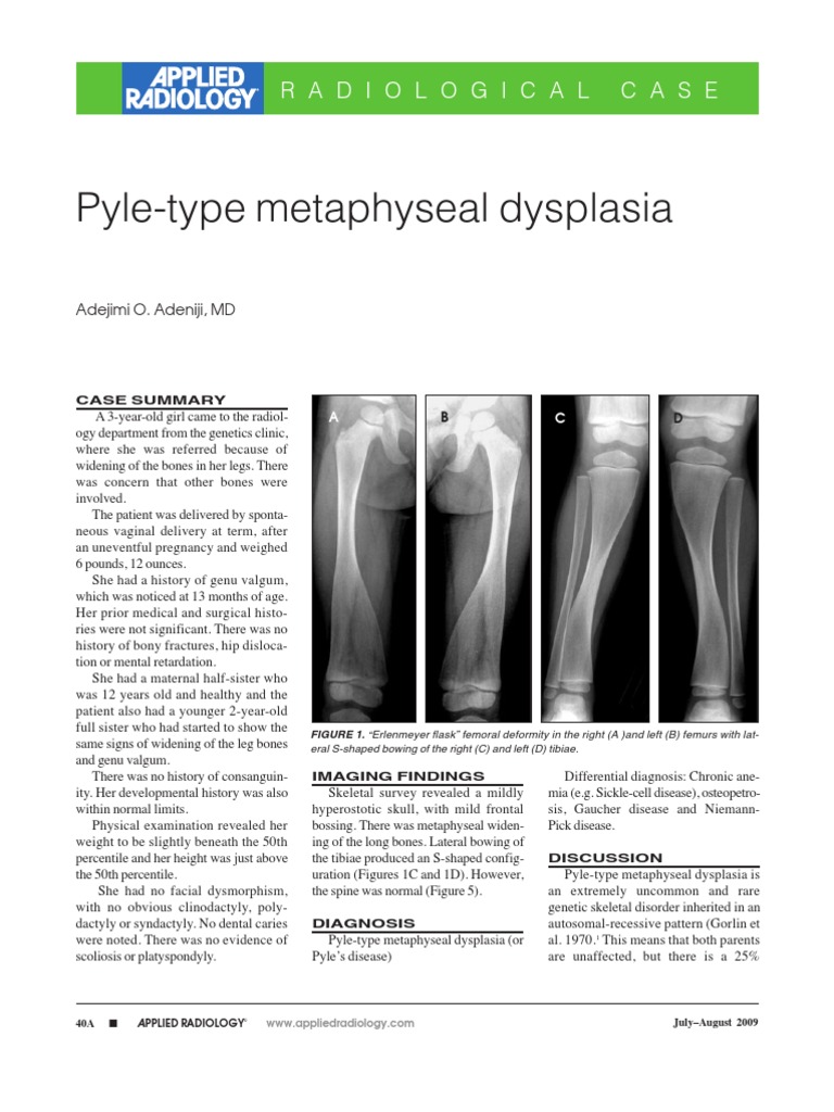 Applied Radiology Case PyleType Metaphyseal Dysplasia