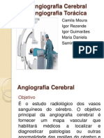 Angiografia Cerebral