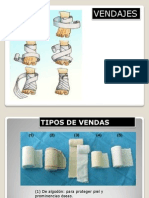 Tipos de Vendas