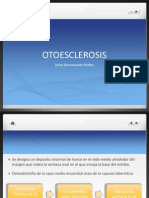 OTOESCLEROSIS