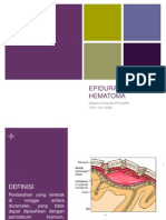 Epidural Hematoma