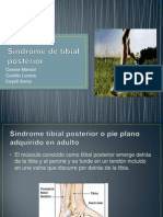 Síndrome de Tibial Posterior