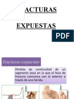 fracturasexpuestas-130720200634-phpapp01.pptx