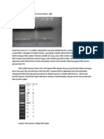 Pembahasan Hasil PCR Dan RFLP