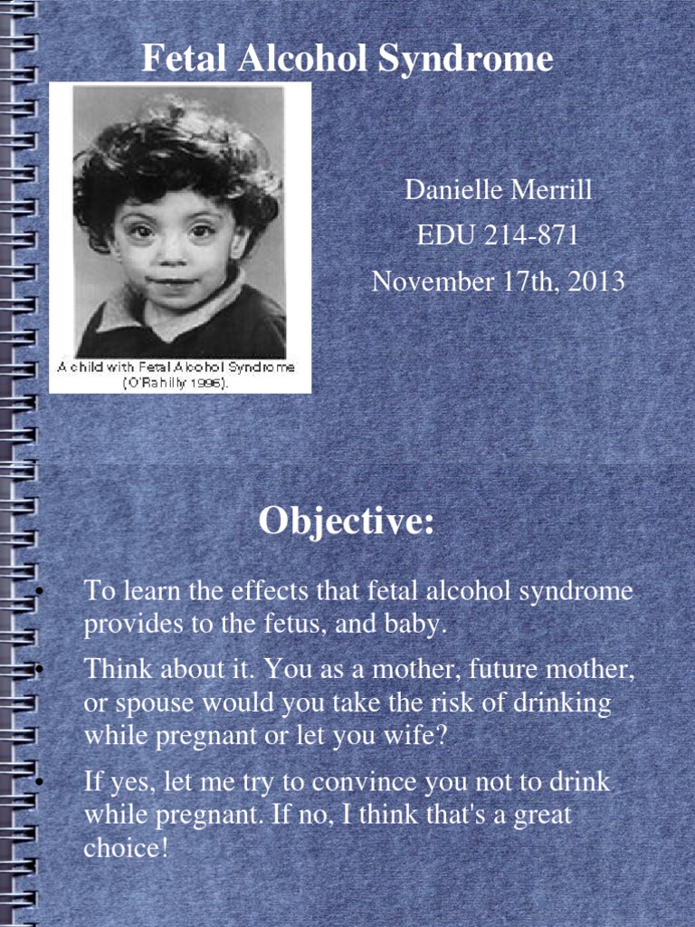 Fetal Alcohol Syndrome | PDF | Fetus | Alcoholism, image size:768x1024