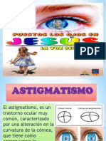 Astigmatism o