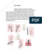 Tipos de Puntos de Sutura Trabajo