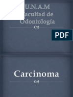 Carcinomaoral 121117180410 Phpapp02