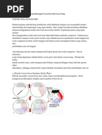 Download Cawan Tuang dan Cawan Gores by Michael_William1990 SN185413821 doc pdf