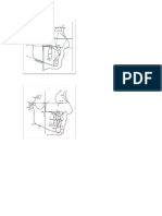 Puntos Craneometricos