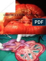 Obstruccion Intestinal