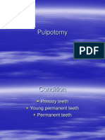 Presentation1 pulpotomi