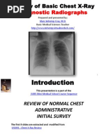 Chest X-ray Interpretation Guide | PDF | Lung | Heart