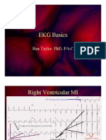 ECG ECG Basics Presentation