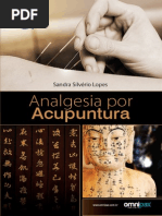 Analgesia Em Acupuntura