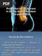 Hernia De Disc Lombară