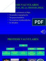 protesis_valvulares