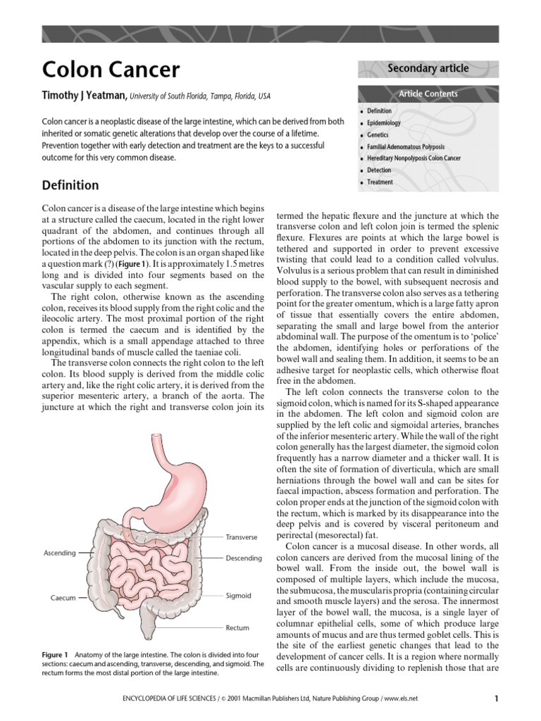 Understanding Colon Cancer Basics | PDF