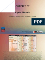 The Basis, Cause, Treatment and Current Research On Cystic Fibrosis